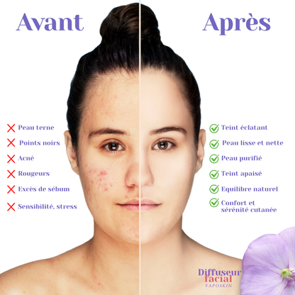 VapoSkin™ – Soin vapeur pour un teint net & lumineux